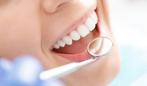 Tooth Extraction