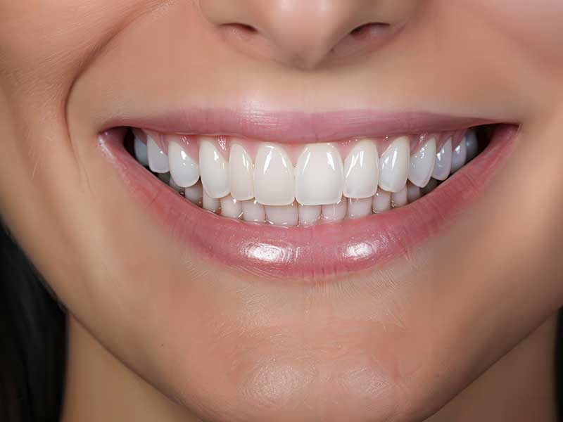 Crown and Bridge Treatment